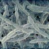 Precautionary Steps To Be Taken While Dealing With Legionella