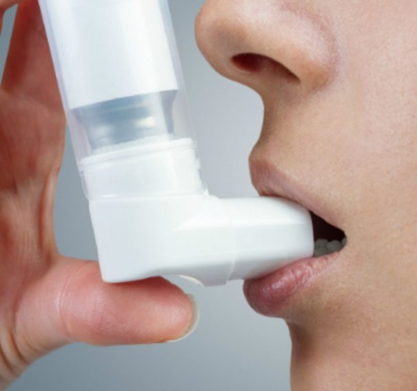 Targeted Oral Treatments For Severe Asthma