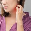 Fungal Infections: What Should You Do?