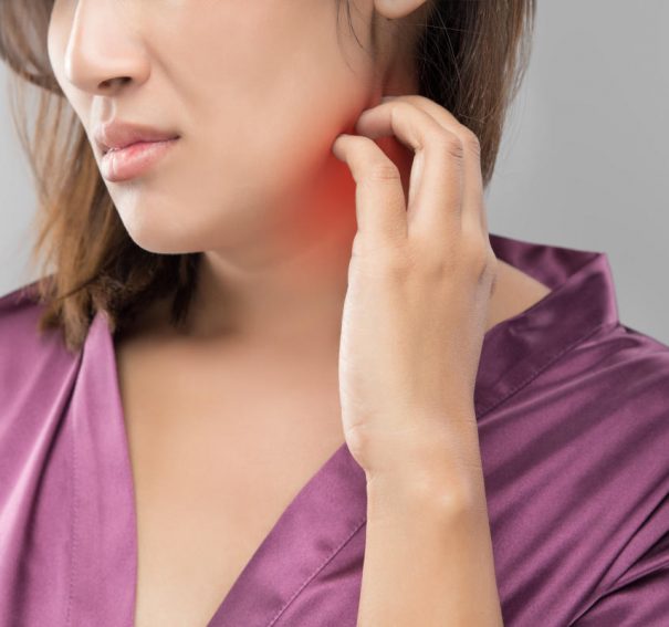 Fungal Infections: What Should You Do?