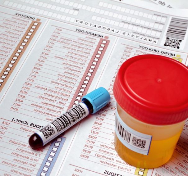 5 Reasons Why You Should Buy Synthetic Urine For Passing A Drug Test