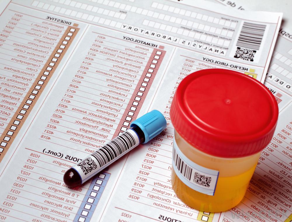 quest diagnostics drug test fake urine